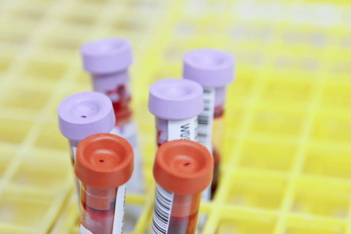 Six blood samples in labelled test tubes